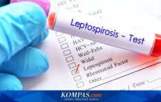 Penyakit Leptospirosis Masih Ditemukan Tiap Tahun di Yogyakarta, Warga Diminta Lebih Perhatian Kebersihan Lingkungan