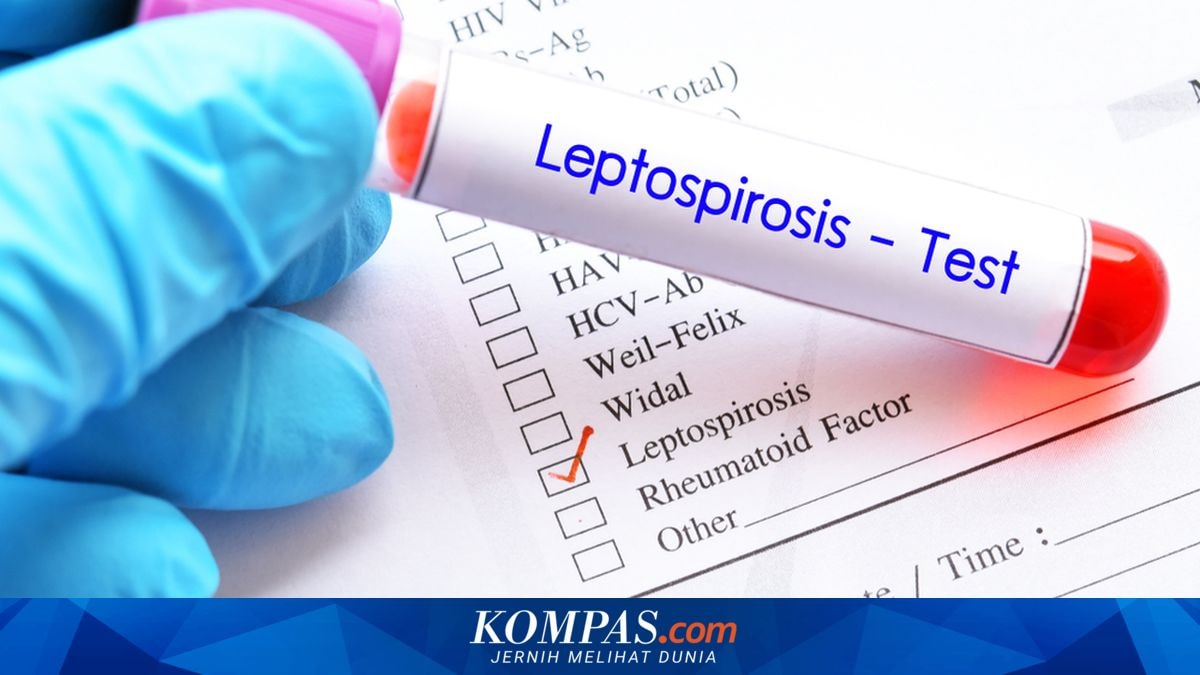 Penyakit Leptospirosis Masih Ditemukan Tiap Tahun di Yogyakarta, Warga Diminta Lebih Perhatian Kebersihan Lingkungan
